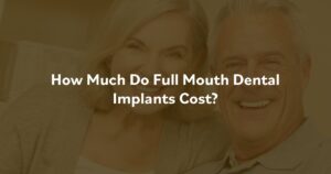 How Much Do Full Mouth Dental Implants Cost? at Southern Oral & Facial Surgery
